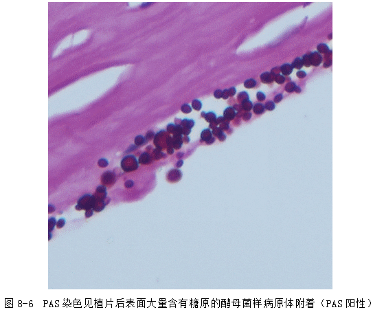 ZY016_35_2.gif